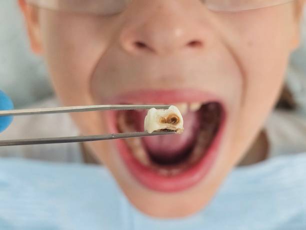 Best Emergency Tooth Extraction  in Spartanburg, SC